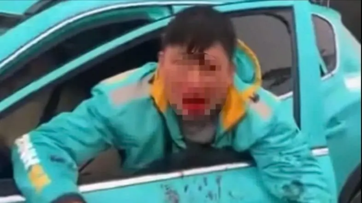 Lái xe ôm công nghệ bị đánh chảy máu miệng